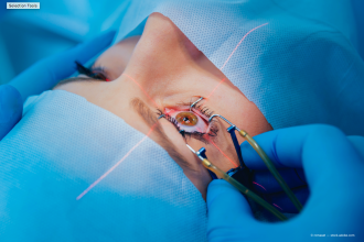 Diabetic Retinopathy and ROP screening, lasers, injection and surgeries