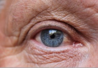 Age-related macular Degeneration (ARMD)