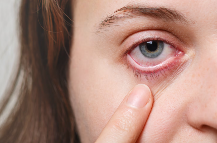 Transition to Thyroid Eye Disease Awareness